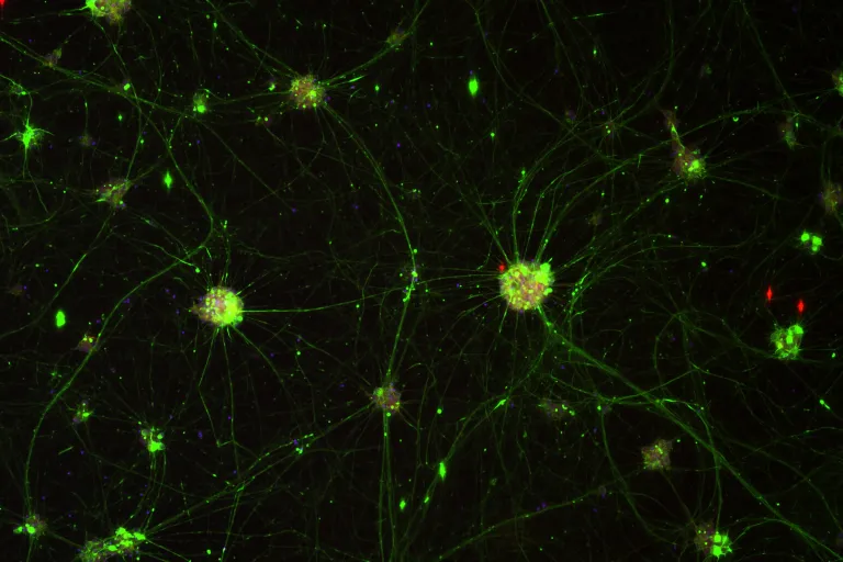 ipsc motorneuron